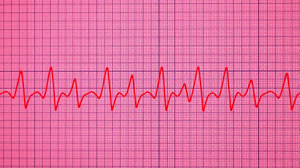 심근경색 진단 방법 (realistic 스타일)